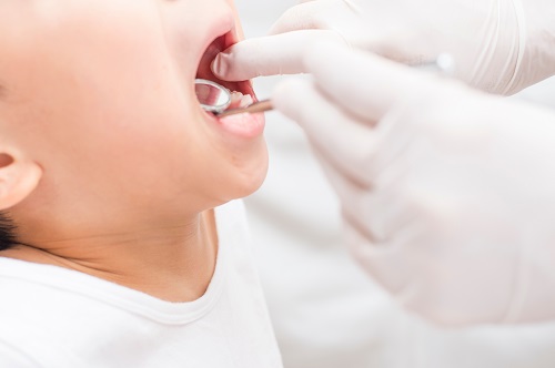 清水歯科医院の子供の治療に対する考え方